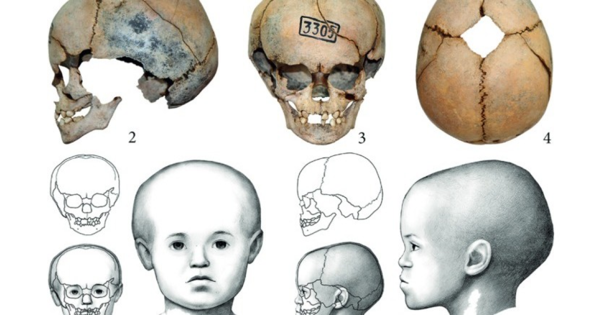 Захоронение древнего малыша с макроцефалией назвали вертикальным или вторичным