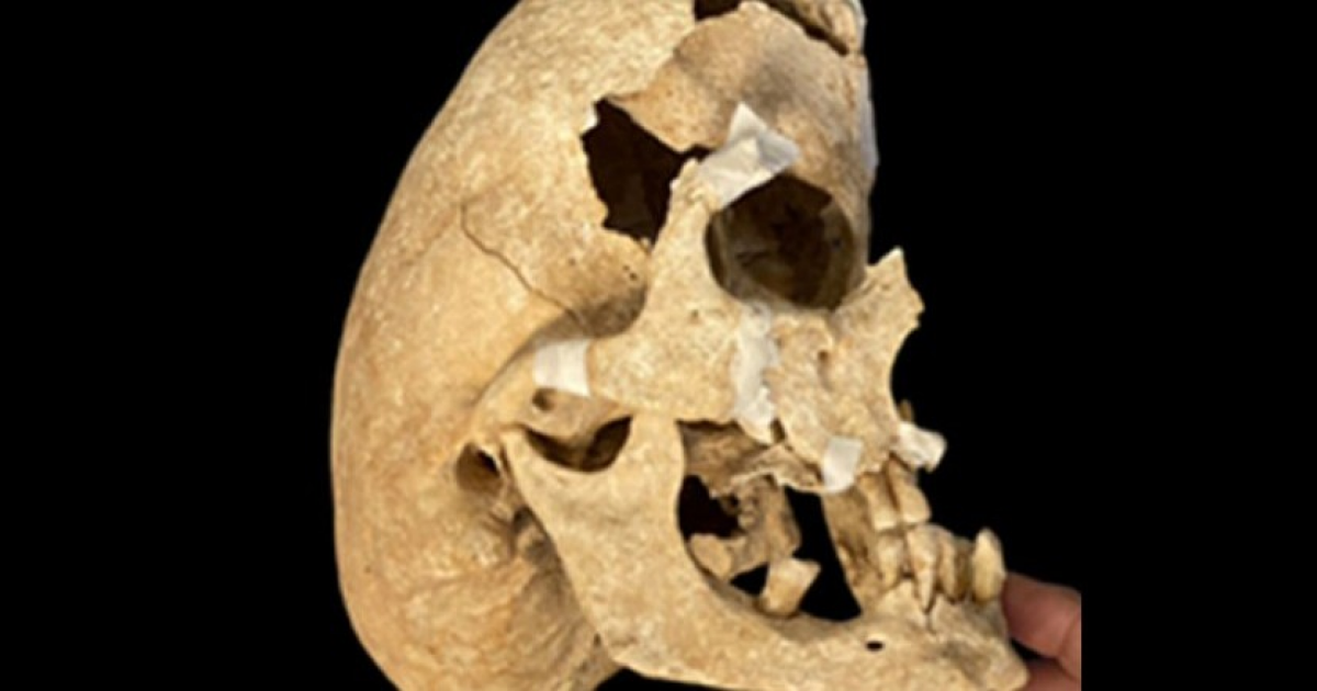 В Испании раскопали скелет рыцаря с ультрадолихоцефальным черепом