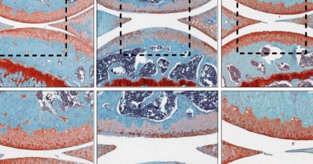 Остеоартрит у мышей повернули вспять с помощью про-простагландинового препарата