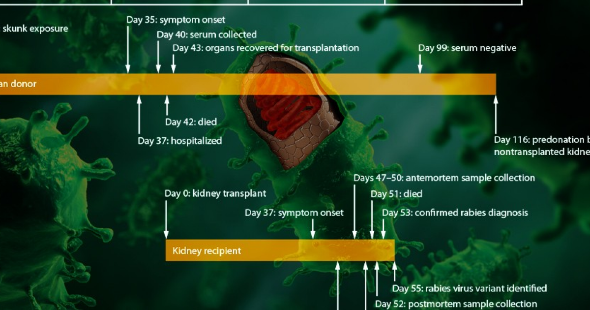Донор пересаженной впоследствии умершему реципиенту почки заразился бешенством от скунса