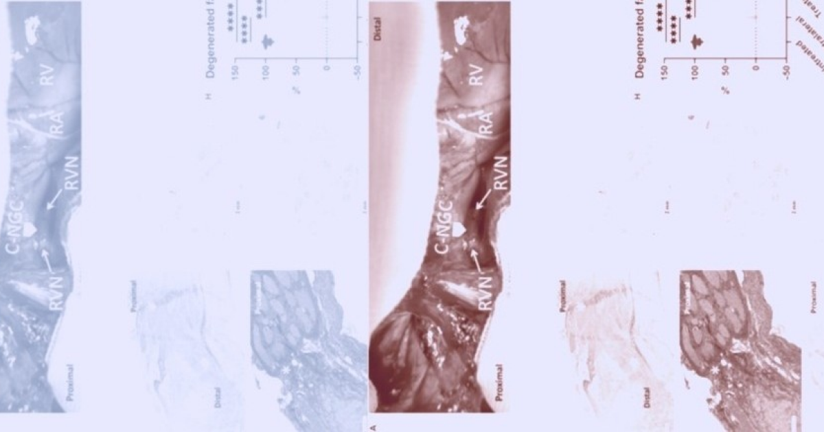 Восстановленный с помощью хитозана блуждающий нерв защитил сердце минипигов