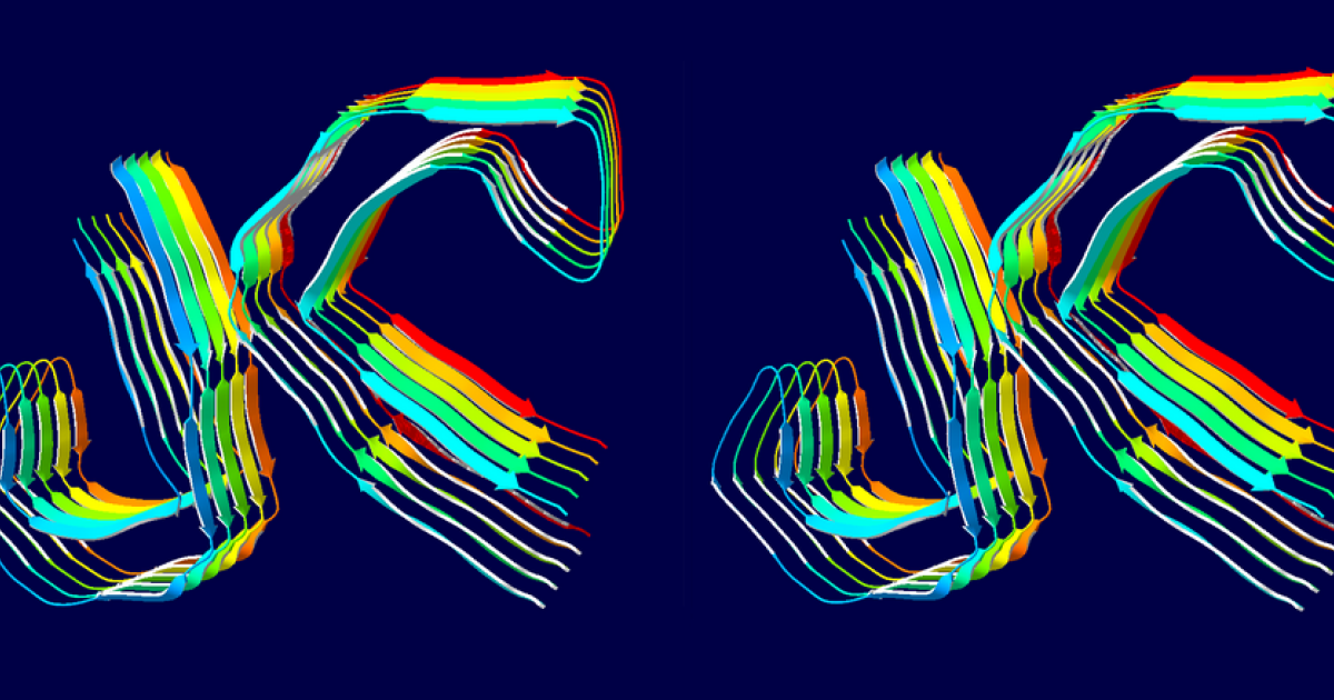 Тау-белок в крови предсказал последствия инсульта