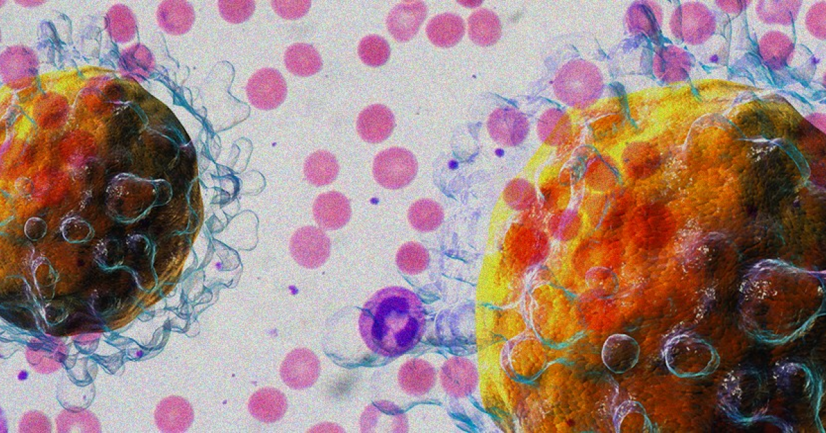 CAR-T-терапия помогла при аутоиммунной анемии в пилотных испытаниях