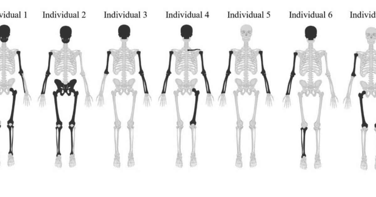 Останки из старинного колодца Ричмонда связали с учебой студентов-медиков
