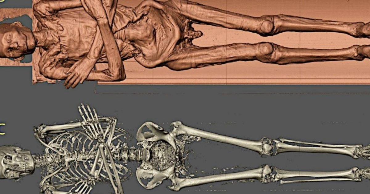 Древнеегипетского жреца убили ударом в область ключицы