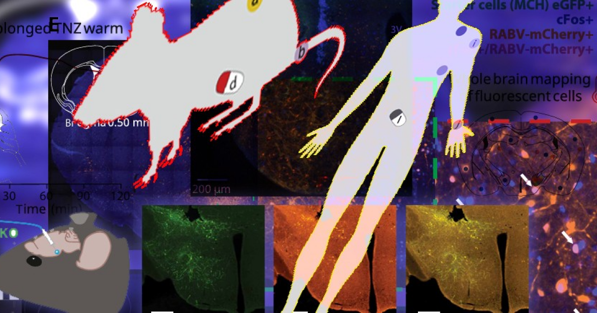 Снижение температуры кожи предсказало катаплексию у людей с нарколепсией