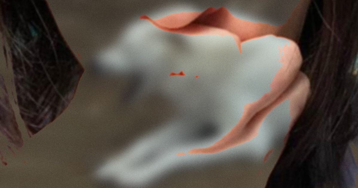 Собачий укус привел к гемолитико-уремическому синдрому у норвежки