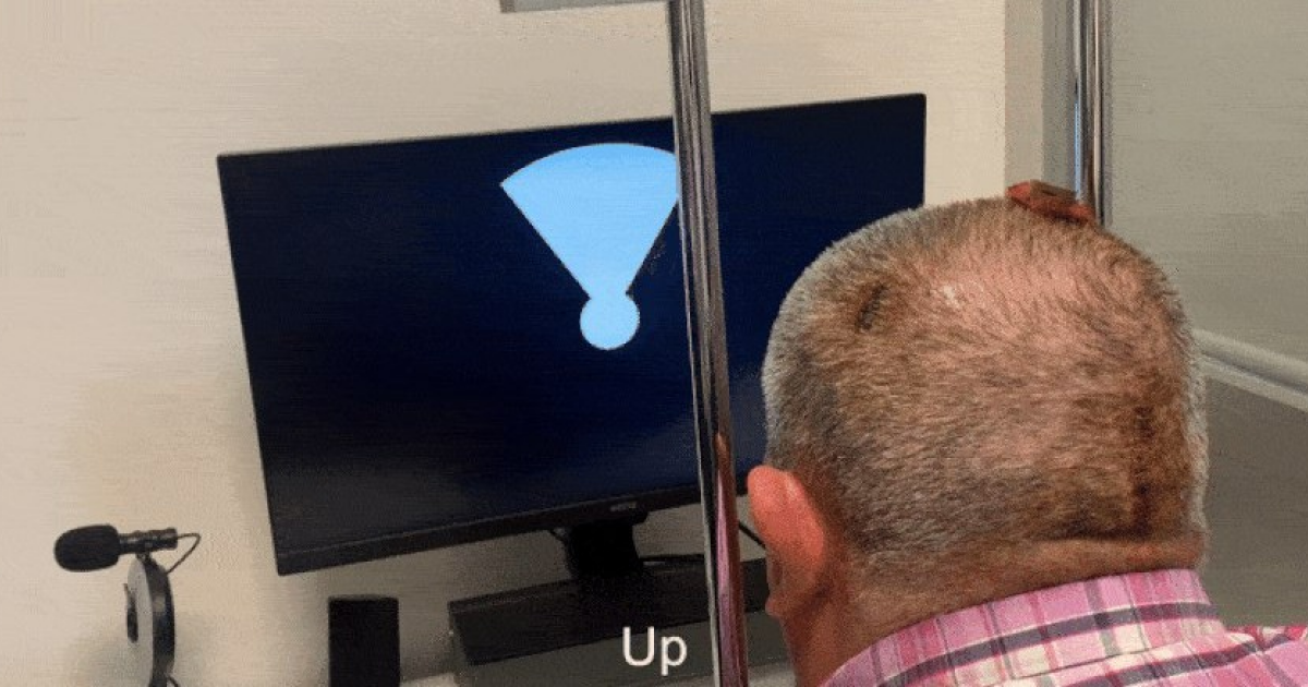 Микростимуляция зрительной коры вернула зрение пожилому испанцу