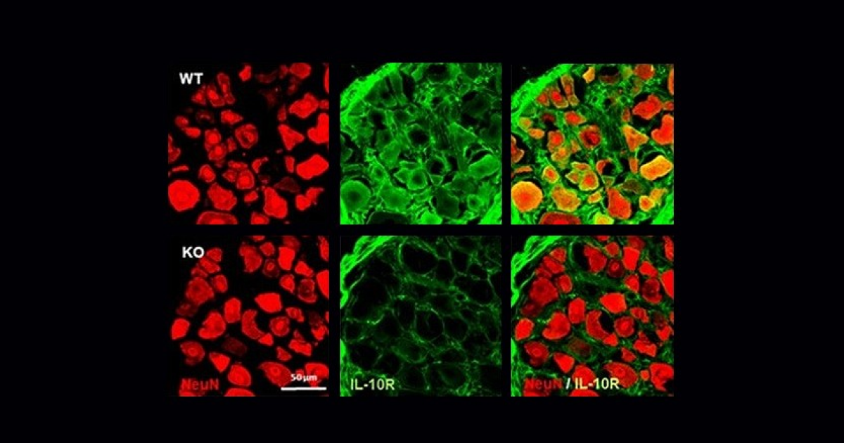 Моноциты помогли мужчинам быстрее женщин избавиться от боли при травме