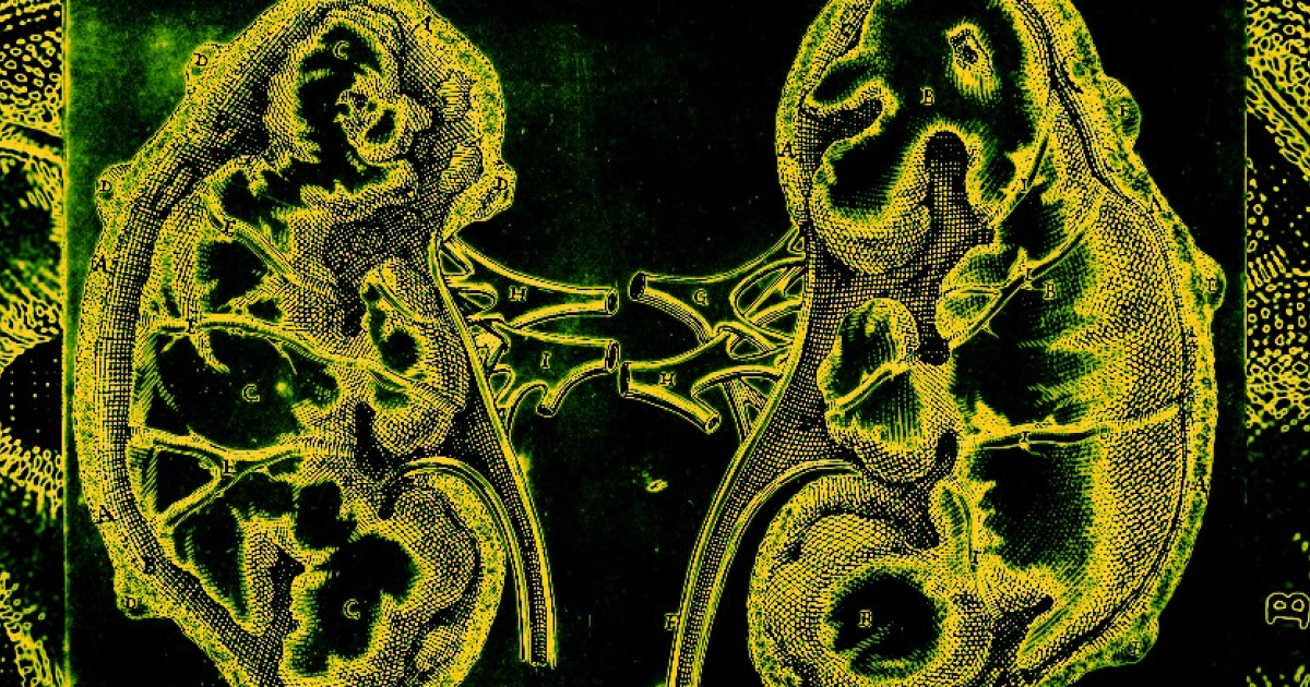 Вода и диета с лекарствами снизили вероятность повторного образования камней в почках