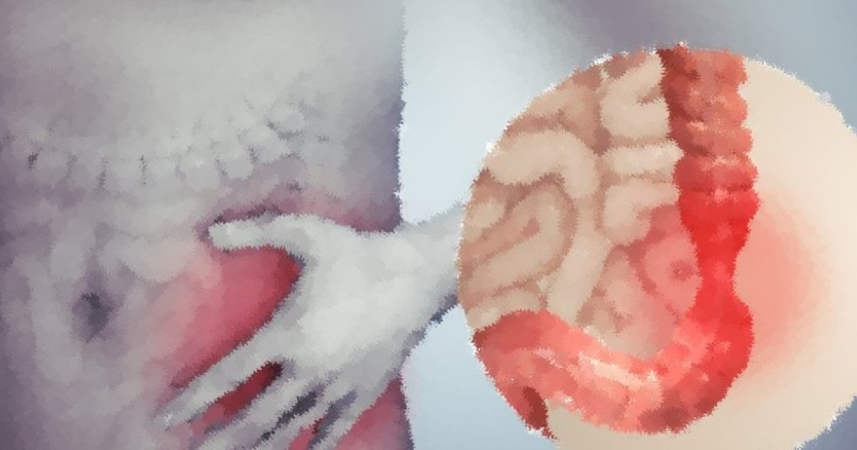 Метаанализ выявил лабораторные признаки синдрома раздраженного кишечника