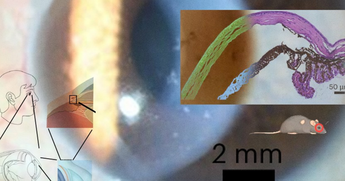 Вирус белоногих креветок вызвал тяжелое поражение глаз у людей