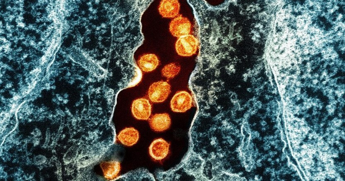 Норвежец избавился от ВИЧ после пересадки стволовых клеток брата