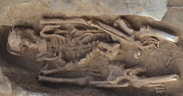 Палеопатологи нашли мочекаменную болезнь у раннесредневекового мужчины