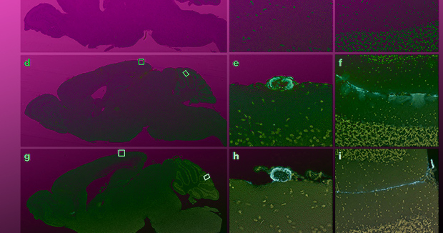 Человеческий бета-амилоид заразил мышей болезнью Альцгеймера