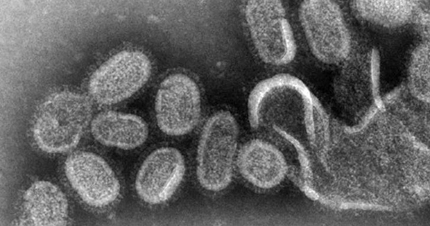 Влияние ожирения на свиный грипп