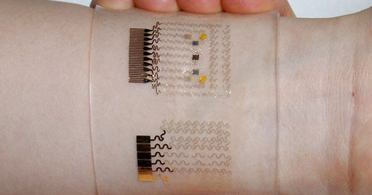Пластырь из графена с золотом поможет контролировать диабет