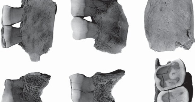 Палеоантропологи диагностировали у алтайского неандертальца ...