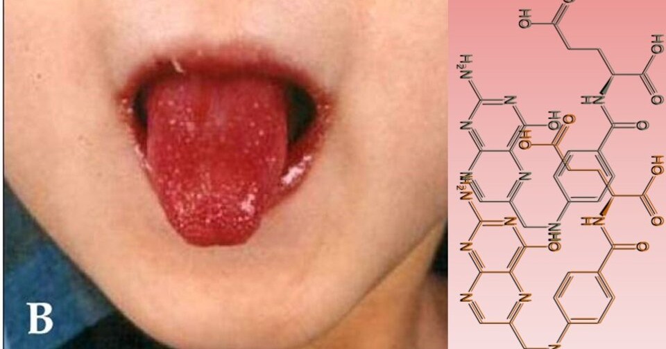 Высокий уровень фолиевой кислоты во время беременности связали со ...